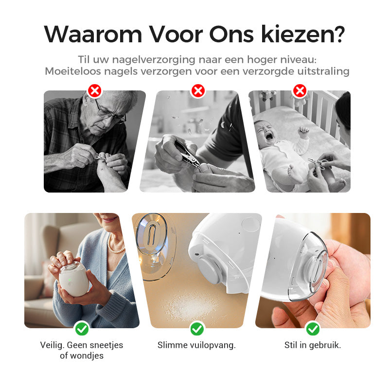 SoftCare Elektrische Nagelverzorger – Veilig, Stil & Precies