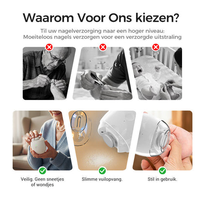 SoftCare Elektrische Nagelverzorger – Veilig, Stil & Precies